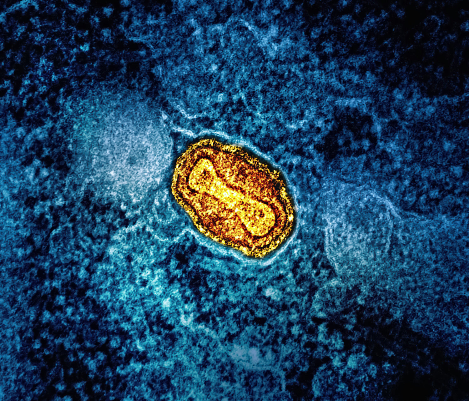 Tired All the Time? It Might Be Your Mitochondria.